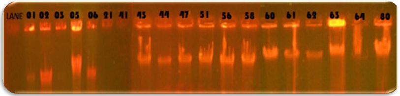 Figure 4: The CASPASE-3 gene expression chart in different groups is the vertical axis of the gene expression and the horizontal axis of the tested groups. R means radiation, D1 is probiotic Lactobacillus casei and D2 probiotic Lactobacillus acidophilus