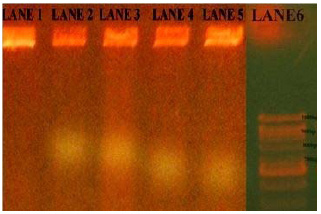 Migration of plasmid DNA fragments in agarose gel electrophoresis (0.7%) at 50volts and Lane 1 to 5 – S. mutans strains and Lane 6 –DNA molecular marker (1kb).
