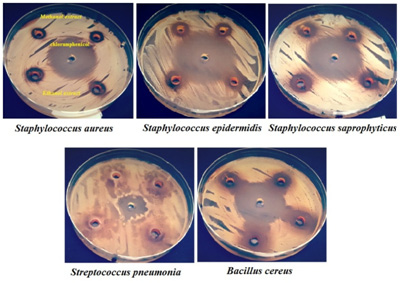 Figure 3: Susceptibility of gram-positive bacteria to methanol and ethanol extracts of S. costus roots compared with chloramphenicol