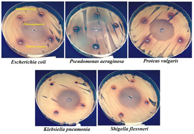Figure 4: Susceptibility of gram-negative bacteria to methanol and ethanol extracts of S. costus roots compared with chloramphenicol