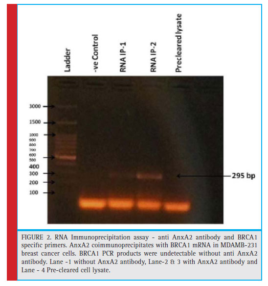 RNA Immunoprecipitation assay - anti AnxA2 antibody and BRCA1 specifi c primers. AnxA2 coimmunoprecipitates with BRCA1 mRNA in MDAMB-231 breast cancer cells. BRCA1 PCR products were undetectable without anti AnxA2 antibody. Lane -1 without AnxA2 antibody, Lane-2 & 3 with AnxA2 antibody and Lane - 4 Pre-cleared cell lysate.