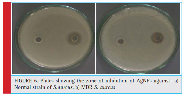 Plates showing the zone of inhibition of AgNPs against- a) Normal strain of S.aureus, b) MDR S. aureus