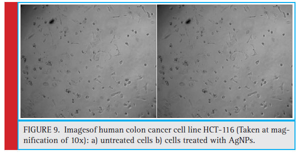 Imagesof human colon cancer cell line HCT-116 (Taken at magnifi cation of 10x): a) untreated cells b) cells treated with AgNPs.