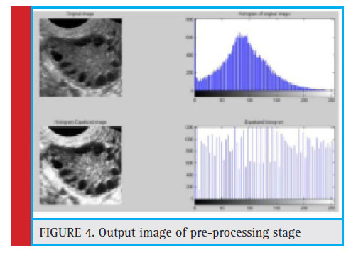 Figure 4: Output image of pre-processing stage