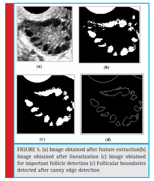 (a) Image obtained after feature extraction(b) Image obtained after linearization (c) Image obtained for important follicle detection (c) Follicular boundaries detected after canny edge detection