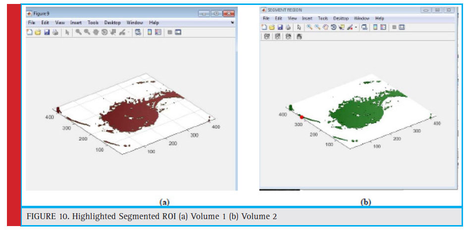 Highlighted Segmented ROI (a) Volume 1 (b) Volume 2