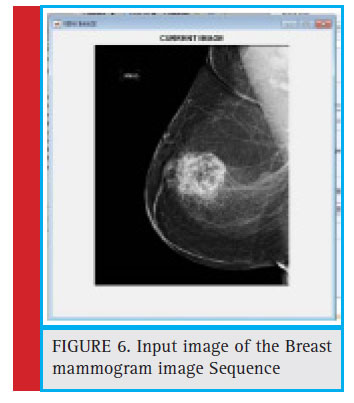 Input image of the Breast mammogram image Sequence