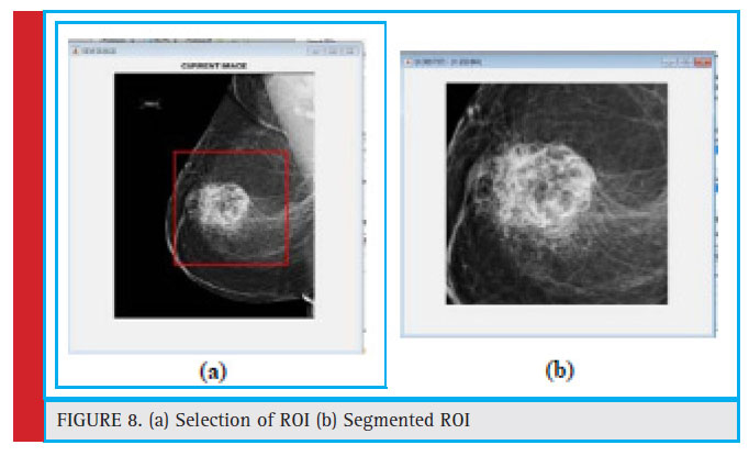 (a) Selection of ROI (b) Segmented ROI