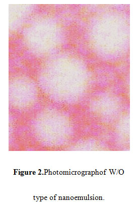 Figure 2.Photomicrographof W/O type of nanoemulsion.
