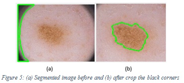 Figure 5: (a) Segmented image before and (b) after crop the black corners