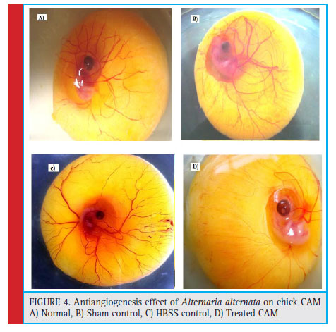 Antiangiogenesis effect of Alternaria alternata on chick CAM A) Normal, B) Sham control, C) HBSS control, D) Treated CAM