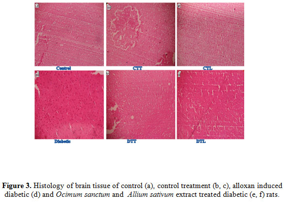 Figure 3. Histology of brain tissue of control (a), control treatment (b, c), alloxan induced diabetic (d) and Ocimum sanctum and Allium sativum extract treated diabetic (e, f) rats.
