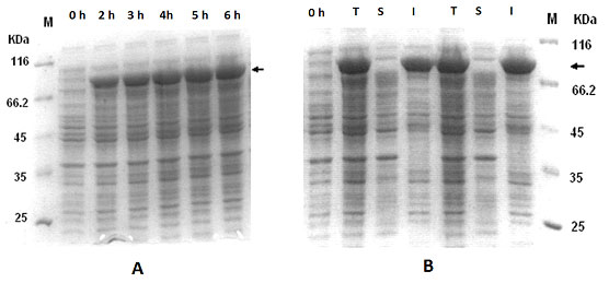 Figure 2: Expression of IFNand nusA fusion protein (pETnusIFN) in E.coli. (A) Comparison of expression level at different post-induction time intervals. (B) Expression profiles showing total cell lysate (T), soluble fraction (S) and insoluble fraction (I).
