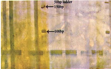 Fig 10: Photograph showing alleles at microsatellite locus (YWLL-46) in Jaisalmeri and Kachchhi camel.