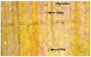 Fig 11: Photograph showing alleles at microsatellite locus (LCA-37) in Jaisalmeri, Bikaneri and Kachchhi camel