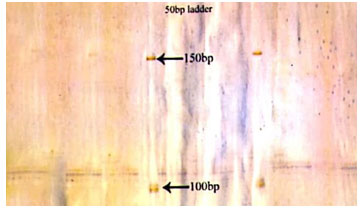 Fig 3: Photograph showing alleles at microsatellite locus (YWLL-44) in Jaisalmeri, Bikaneri and Kachchhi camel.