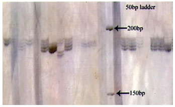 Fig 7: Photograph showing alleles at microsatellite locus (YWLL-38) in Bikaneri camel. 