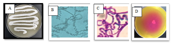 Figure 1. The selected isolate MM 11 on starch nitrate agar containing three antibiotic (A), on slide agar (B), stained with Gram stain (C) and screened for L-glutaminase using phenol red as indicator (D)