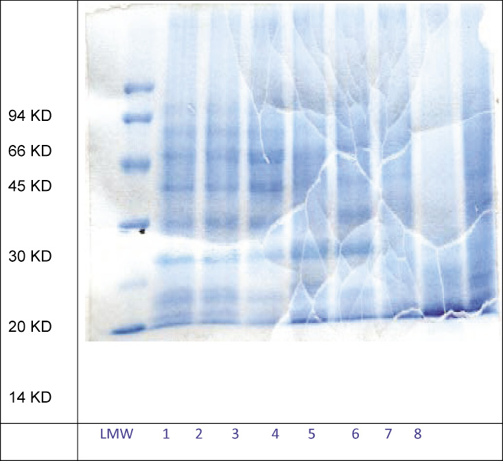 Figure 1: SDS-PAGE of HBsAg extracted from cell lysate using different chaotropic agents