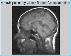 Figure 10: Removing noise by wiener filter