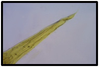 Figure 12: Posterior end of Strongyloides sp. female(100x)