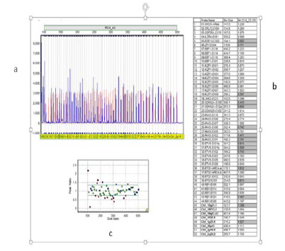 Figure 2: The OCN gene expression chart in different groups is the vertical axis of the gene expression and the horizontal axis of the tested groups. R means radiation, D1 is probiotic Lactobacillus casei and D2 probiotic Lactobacillus acidophilus.