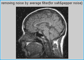 Figure 6. Removing noise by mean filter