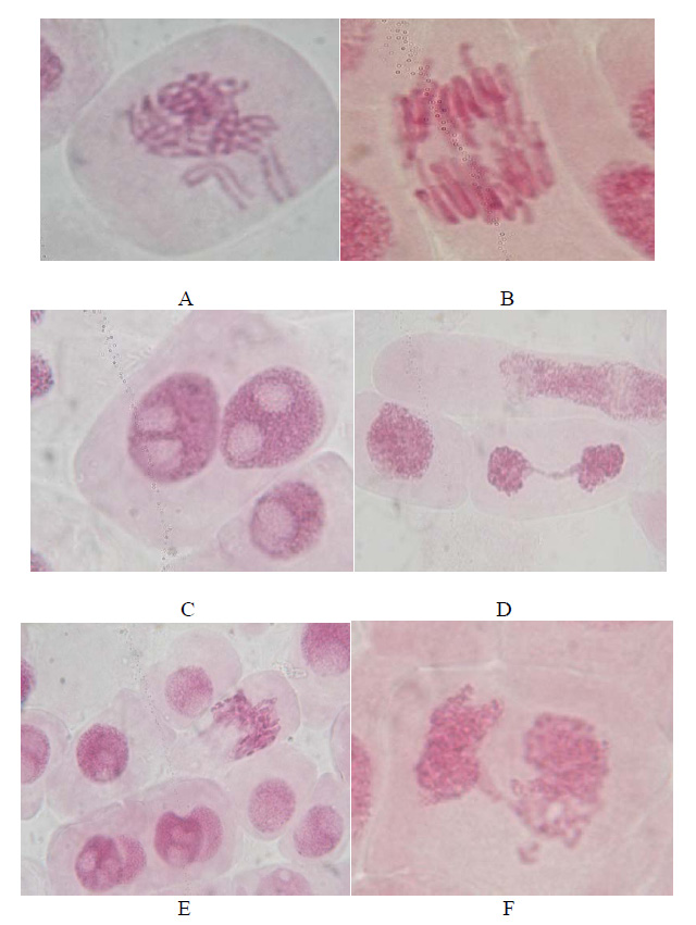Figure 6: Allium cepa meristematic cells showing the alterations due to the action of industrial effluent and domestic sewage; A-irregular metaphase, with unorganized chromosome, alsoknown as C-metaphase, showing chromosomes with no orientation on the equatorial plate; B-irregular anaphase,with anaphasicmicrobridges; C-irregular cell, binucleate, with an elliptical aspect; D-telophase bridge; E-cell with adherent or damaged nucleus, F-irregular cell; G-metaphase with numerical alteration, due to duplication of the number of Chromosomes.