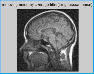 Figure 9. Removing noise by mean filter