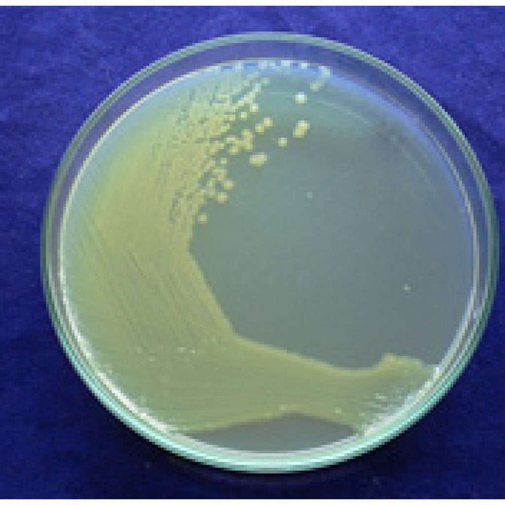 On the Prevalance of Selected Serotypes of Enterobacteriaceae Pathogens ...